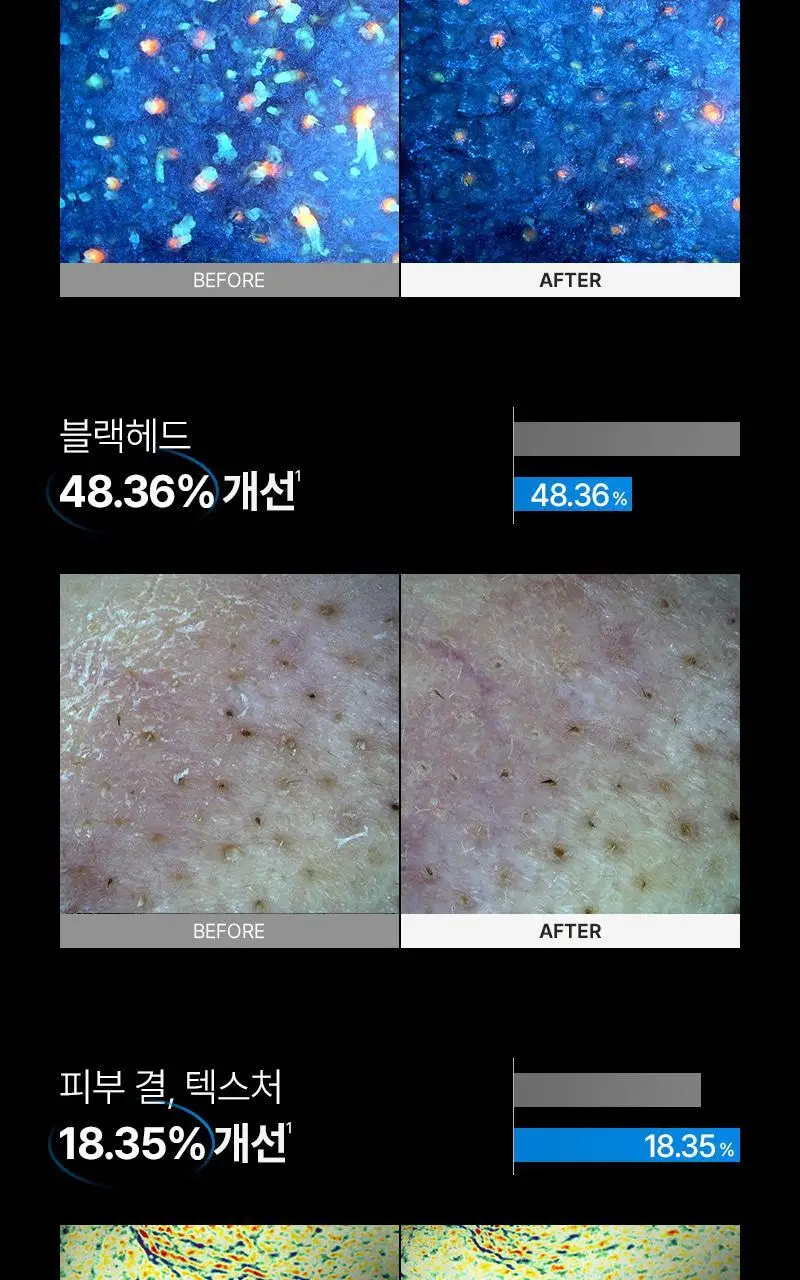 [모공 수, 모공부위 탄력개선, 300만 플라즈마 샷] 피캄 클리어 프로 상세페이지 14
